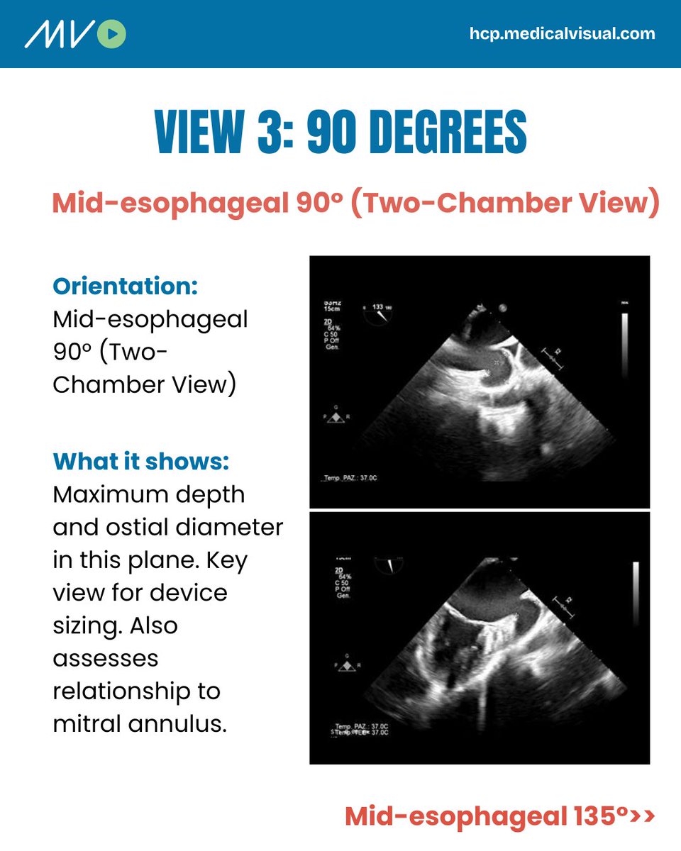 CardioVisual: Powered by MedicalVisual tweet media