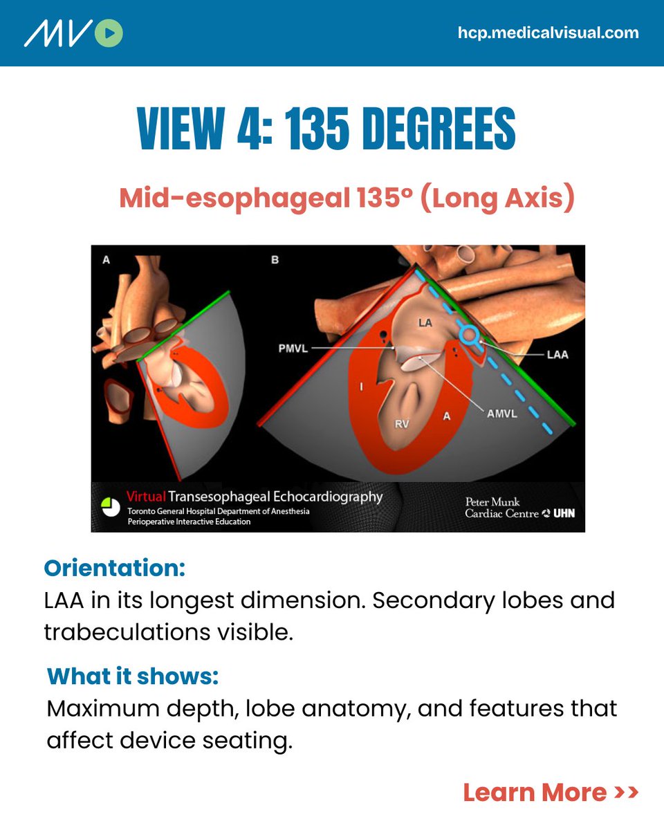 CardioVisual: Powered by MedicalVisual tweet media