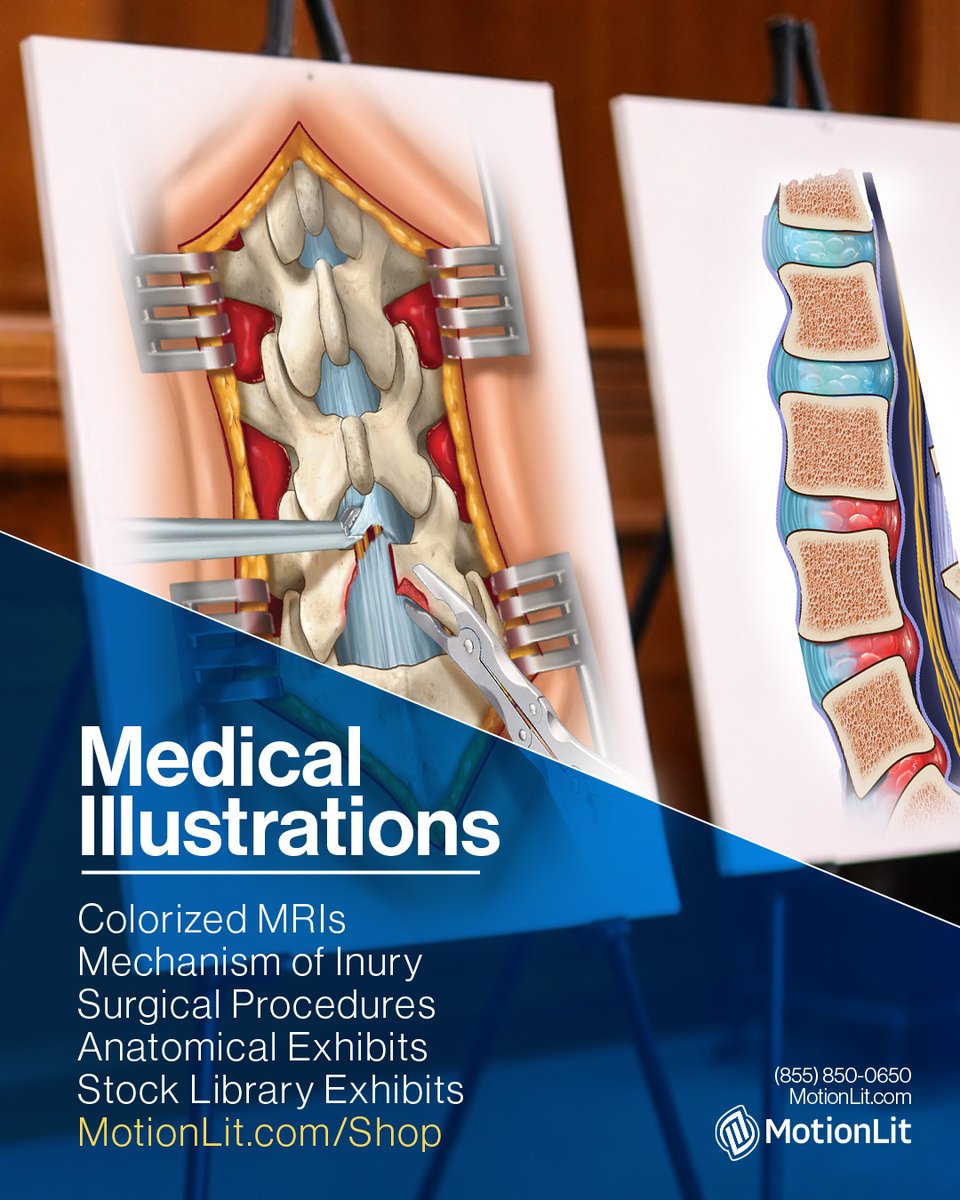 MotionLit's tweet photo. “When details matter… they should be presented.” Our team develops medical illustrations that present injuries, procedures, and anatomy with precision to support medical findings in a case.  #MedicalIllustration #AnatomicalExhibits  👉 https://t.co/qmQPzK5AmS https://t.co/M5KeUwOXIu
