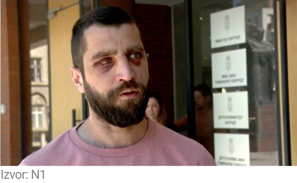joovanica88's tweet photo. Čovek otet, pretučen brutalno, vožen u autu bez tablica, pokušano iznuđivanje „priznanja” i ponižavan.
Prošlo 14 dana, niko uhapšen.
Ovo je zemlja u kojoj građanin može biti otet zbog nalepnice "Studenti pobeđuju", a otmičar zaštićen zbog partijske knjižice.

ODGOVARAĆETE! https://t.co/taZx011Jr5