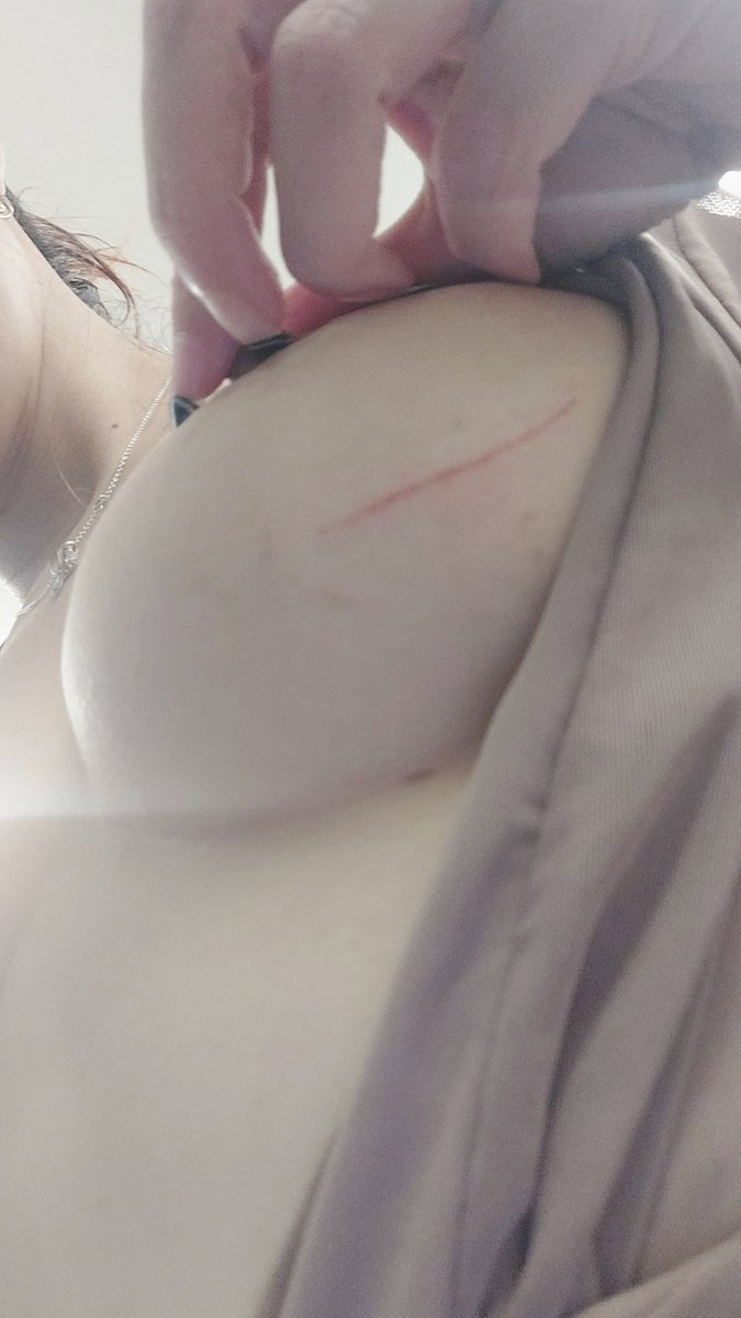 𝐒۝´Ꮃ𝖍𝖆𝖙•🥀I`𝖆m.ೃ࿐ tweet media