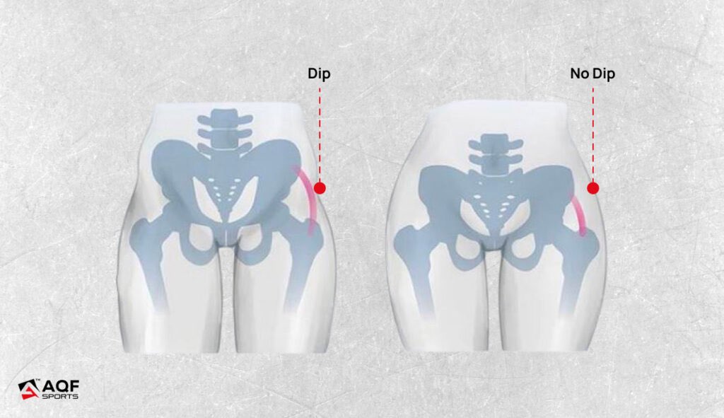 whiptears's tweet photo. why is my pelvis ugly #damn https://t.co/PklFONTz77