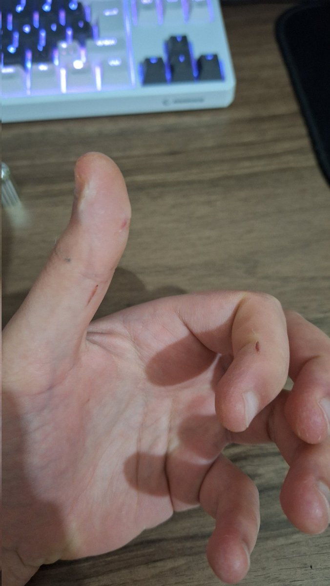 LyHumblee's tweet photo. Şişenin kapağını yamuk bastığınız için parmaklarım kesildi teşekkürler! @eyupsabrituncer https://t.co/mCcWEedw9s