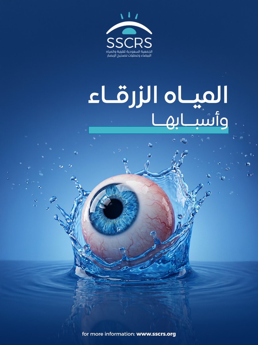 SSCRS_'s tweet photo. 👁️المياه الزرقاء (الجلوكوما) قد تتطور بصمت 
في كثير من الحالات ما تظهر أعراض واضحة إلا في مراحل متقدمة، لذلك الفحص الدوري هو الأهم للحفاظ على البصر
لا تنتظر الأعراض… بادر بالفحص

#المياه_الزرقاء #الجلوكوما #فحص_العين #صحة_العين #SSCRS https://t.co/jNozHMjwIT