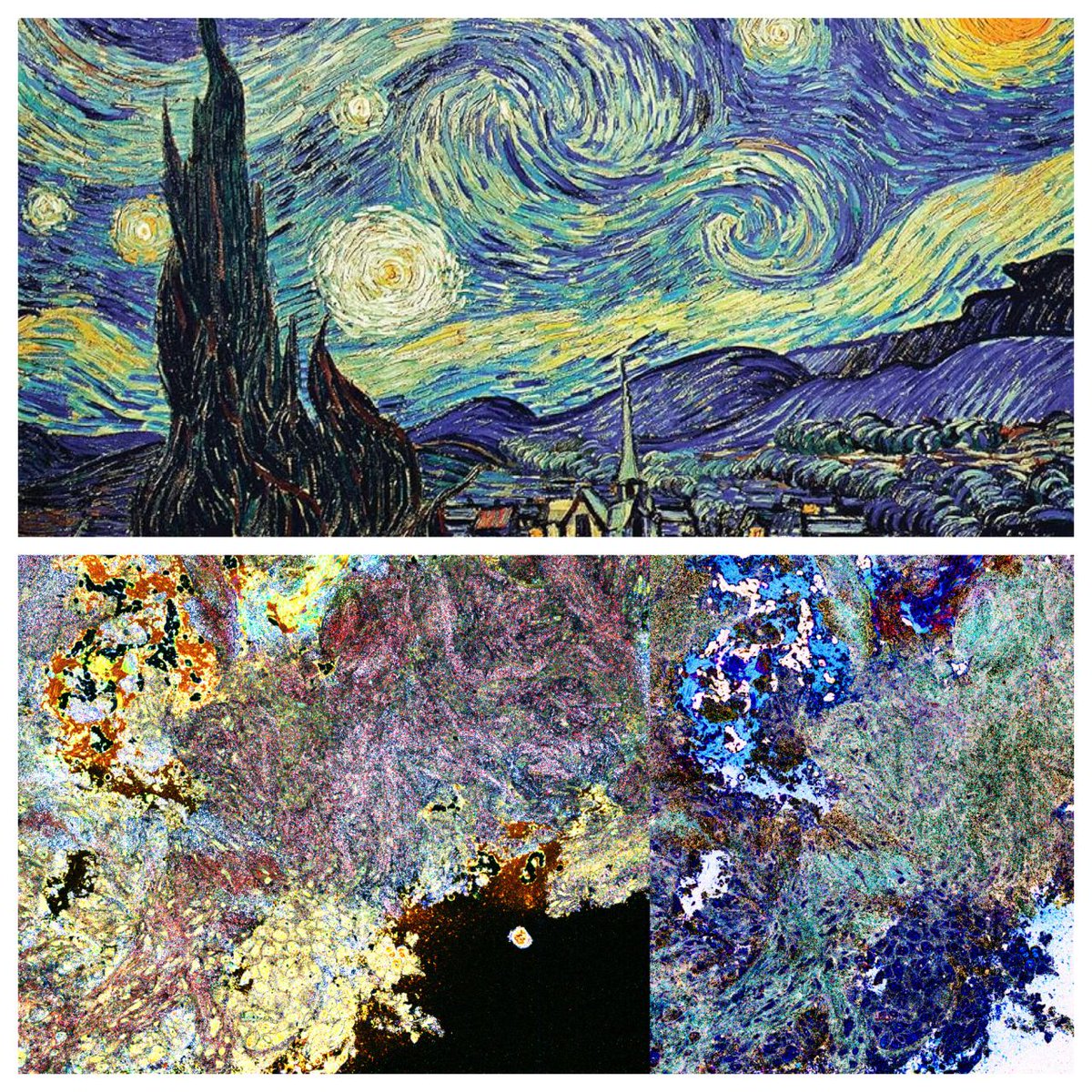 celltivity's tweet photo. We’re proud to partner with Hillcrest HealthCare System bringing the Van Gogh™ Microscopy System to their advanced lung program. Thank you to Dr. Rachael Pattison for leading the charge to make this technology available to patients in Oklahoma. #CellTivity #VanGogh #LungCancer https://t.co/u1QZQ2k1rC