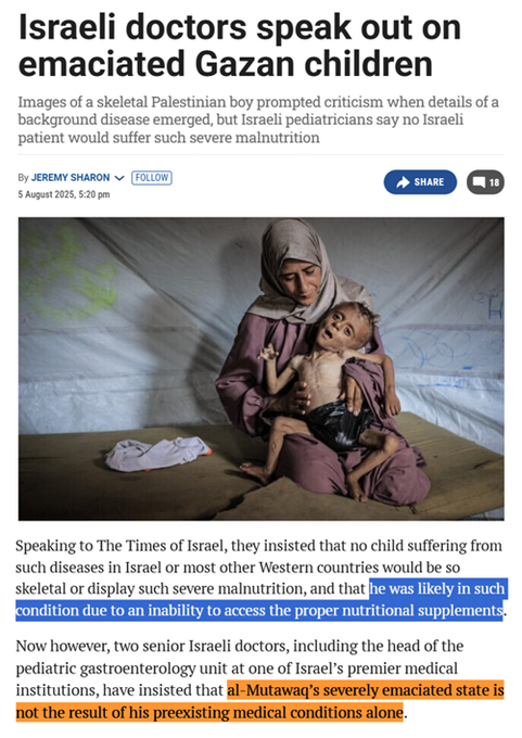 ibrahimibnyusuf's tweet photo. @mishtal @nytimes Israeli doctors confirmed the child looked like he did because Israel blocked the entry into Gaza of the nutritional supplements he needed for his condition.

So that yes, he was deliberately starved by Israel. https://t.co/RYqzSwN0J0