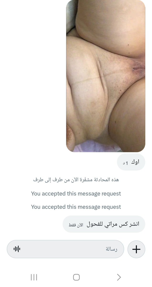 AlhwawyMar49700's tweet photo. زوجها يحب يعرف رايكم في كس زوجتو https://t.co/Xm3vh2fscL