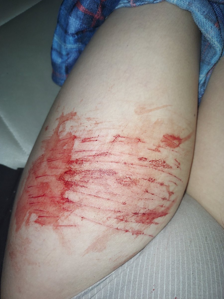 cut slut 🩸🔪 tweet media