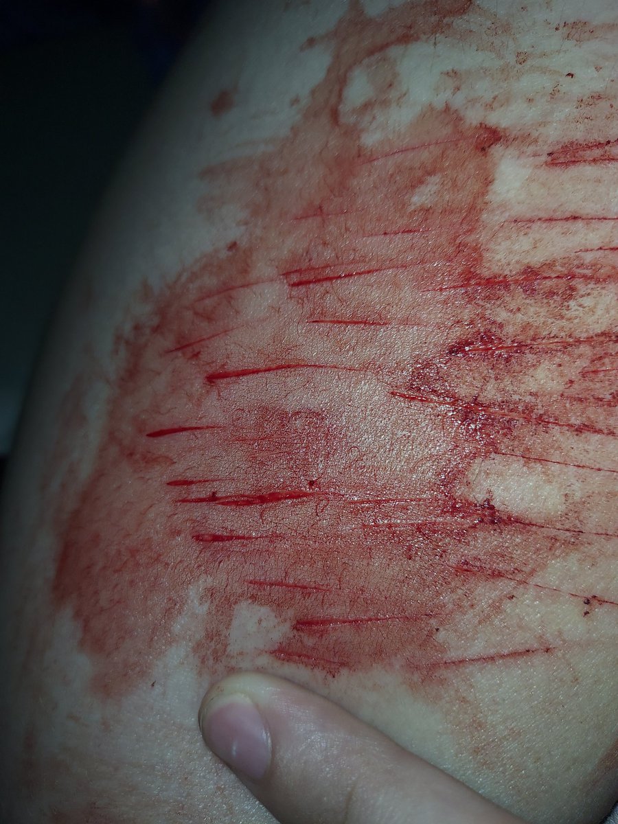 cut slut 🩸🔪 tweet media