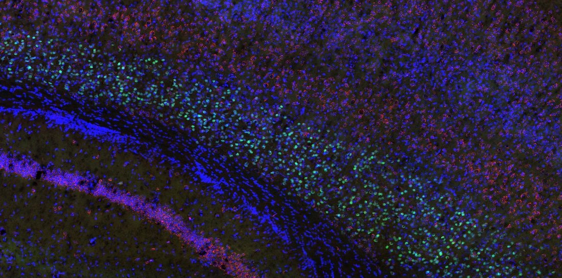 UT Southwestern O'Donnell Brain Institute tweet media