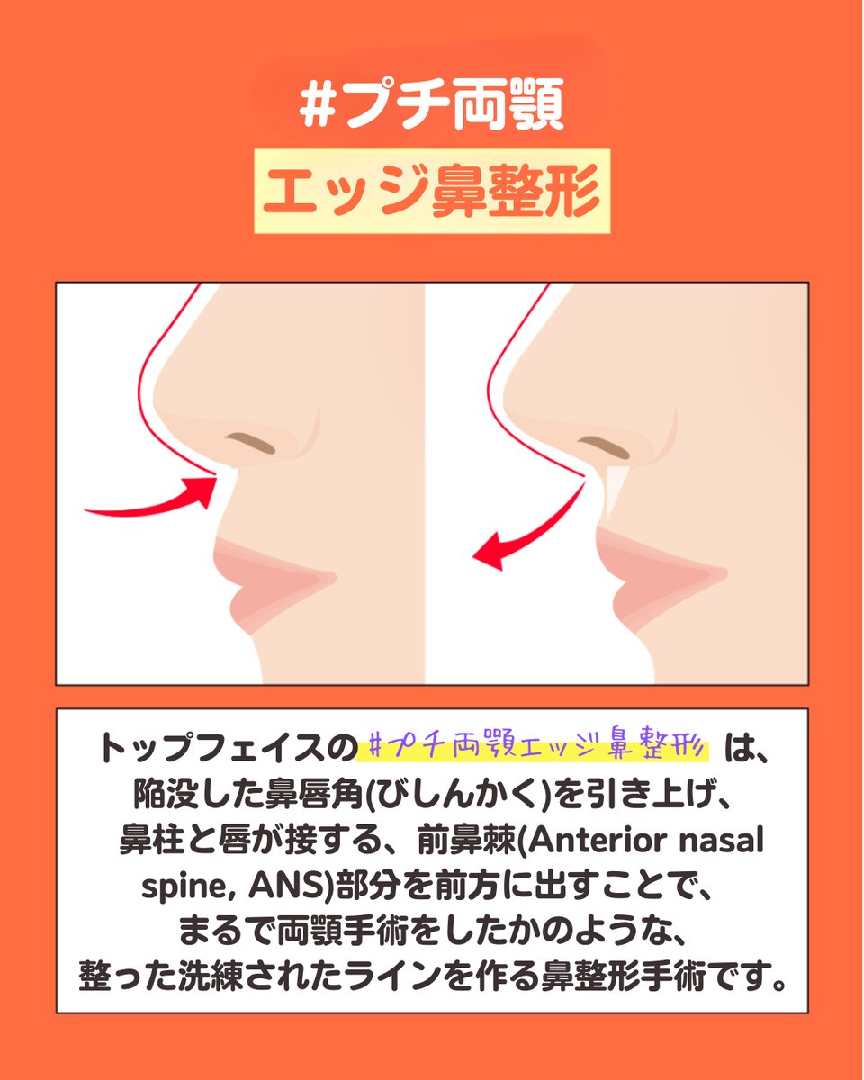 トップフェイス整形外科/目再手術・鼻再手術 tweet media
