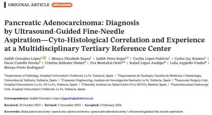 DiagnosticCyto's tweet photo. Open Access June 2026 issue of @DiagnosticCyto  
Pancreatic Adenocarcinoma: Diagnosis by Ultrasound-Guided Fine-Needle Aspiration Cyto-Histological Correlation and Experience at a Multidisciplinary Tertiary Reference Center @aakasharmand 
https://t.co/o5e6l4eoUD https://t.co/0U3yCYnANi