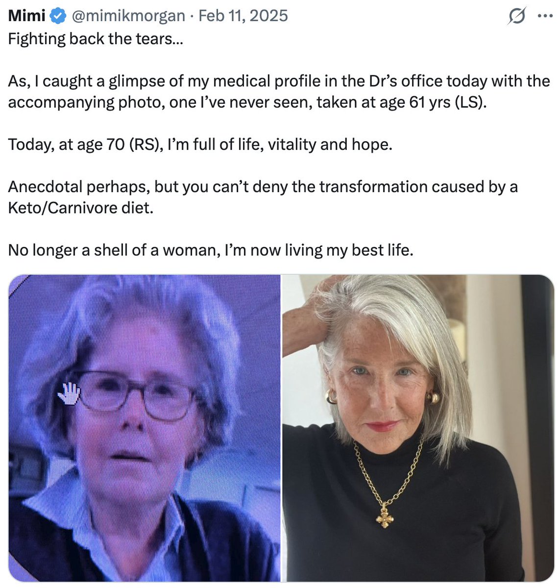 vornado17's tweet photo. @itslinklauren THIS is health. Mimi at 62 and today at 71. Eating real food and moving her body. Demi looks like a corpse. https://t.co/txHNZxXp4d
