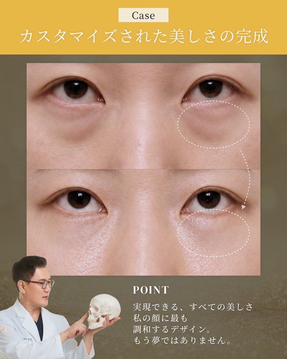 韓国ST美容整形外科 tweet media