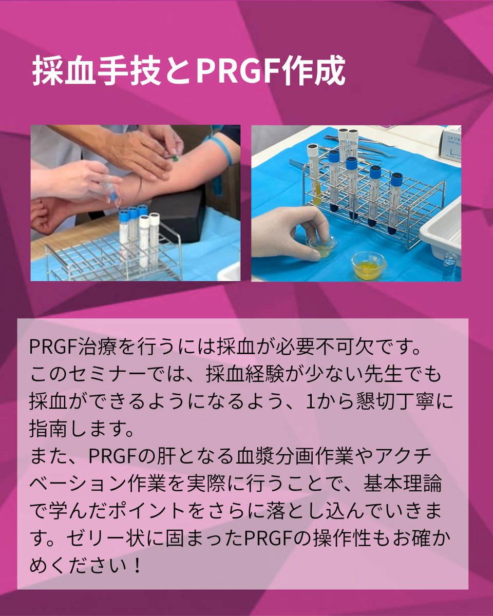 BtiJapan's tweet photo. 【ベーシックセミナーのご案内】 
日時：2026年6月7日（日）9:00～13:30 
場所：エッサム神田ホール1号館（神田駅すぐ） 
費用：1歯科医院（3名まで）¥40,000円(税抜) 
講師：加藤嘉哉先生 
お申込：ホームページよりお願いいたします↓
https://t.co/EYJauUzi9a https://t.co/XHdrtKI7i0