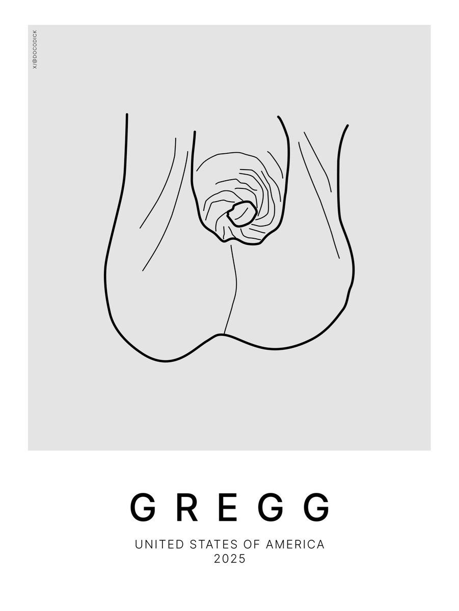 DocoDick's tweet photo. “I was circumcised at birth and restored my foreskin” - Gregg

So many opinions on the subject of circumcision. What’s yours?

#circumcision #circumcized #penis #consent #boys #cut #foreskin #restoration #bro #opinion https://t.co/uF6cNhjiea