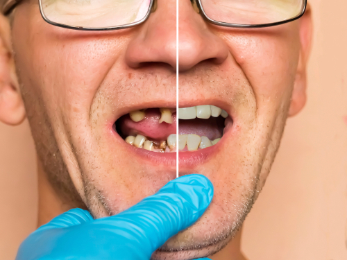 drapeldds's tweet photo. With a smile makeover, you can look forward to a transformation that boosts your confidence and leaves a lasting positive impression. #melbourne #florida #dentalimplants #dentist https://t.co/CxdoLoKp0R https://t.co/sC3jCm5Trn