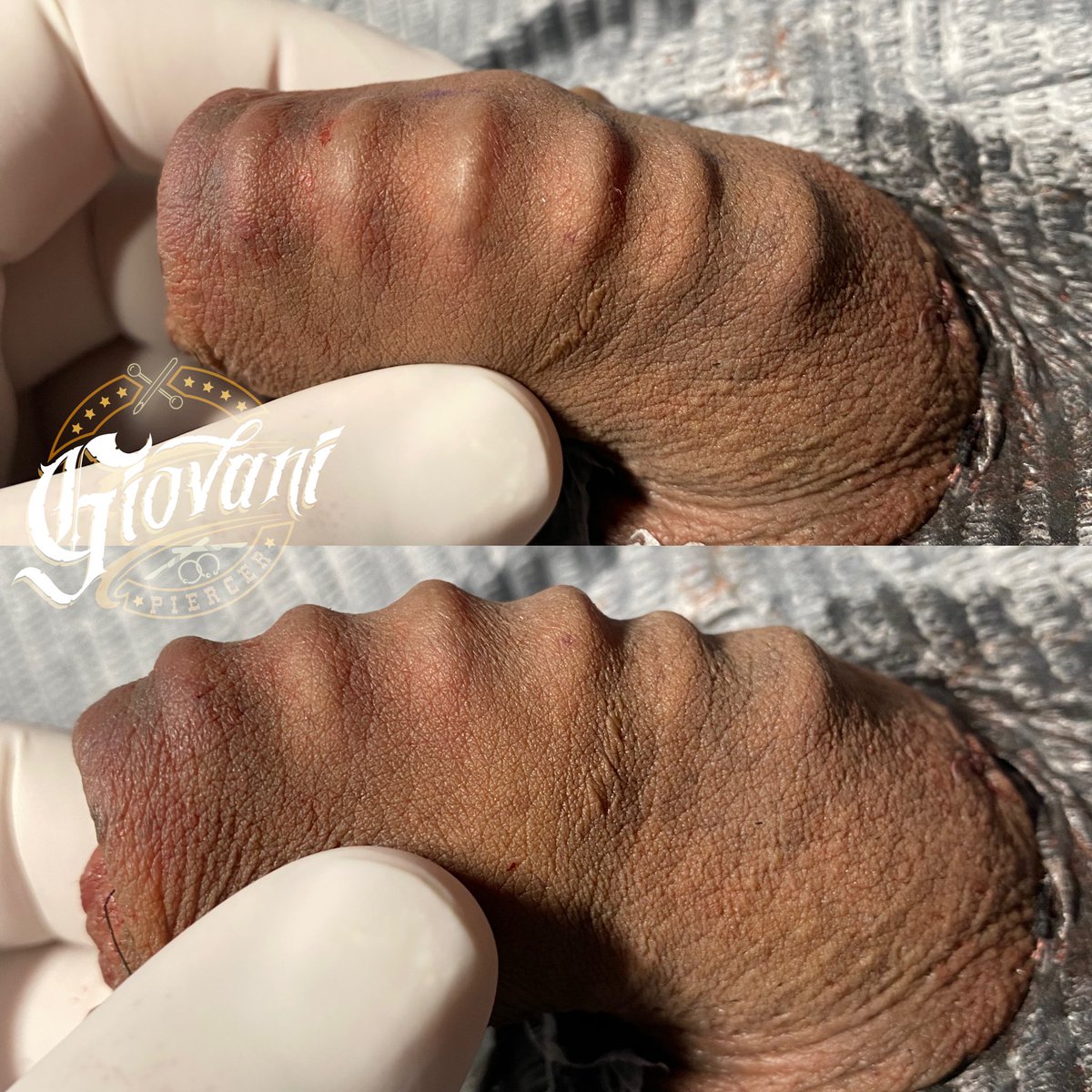 giobodymod666's tweet photo. PE**lING 😈
implante de silicon de 6 ribs
Citas disponibles para este y otros procedimientos me encuentro en León Guanajuato contáctame al 4771156206 recuerden que tambien se pueden colocar en pene de sangre 🩸
#implante #implantesubdérmico #leongto #leonguanajuato #guanajuato https://t.co/6vuCUCt7rz