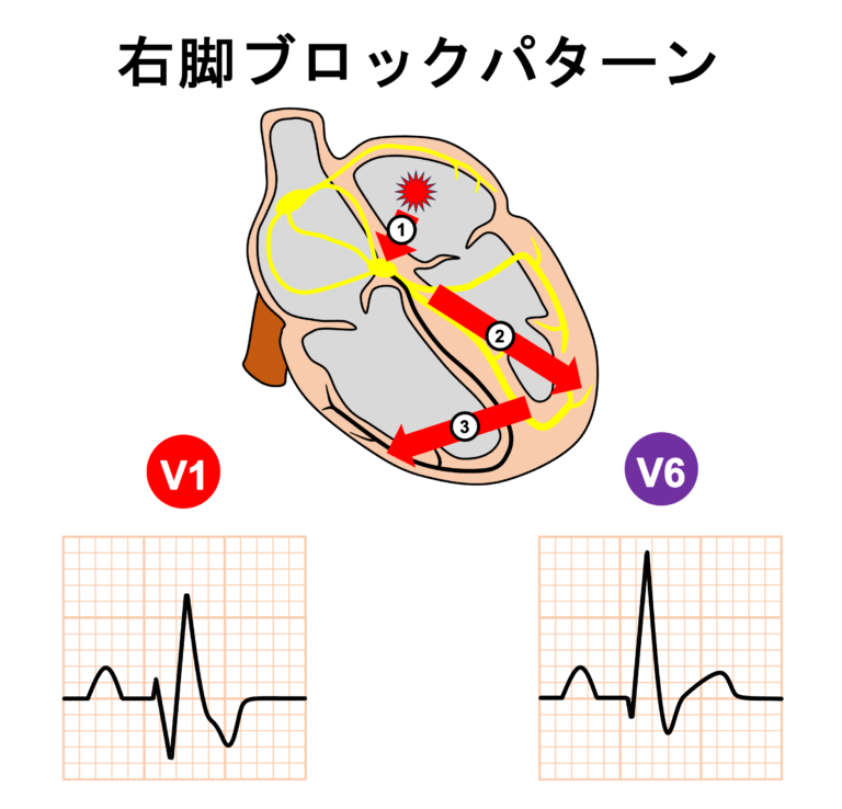 心電図.com tweet media