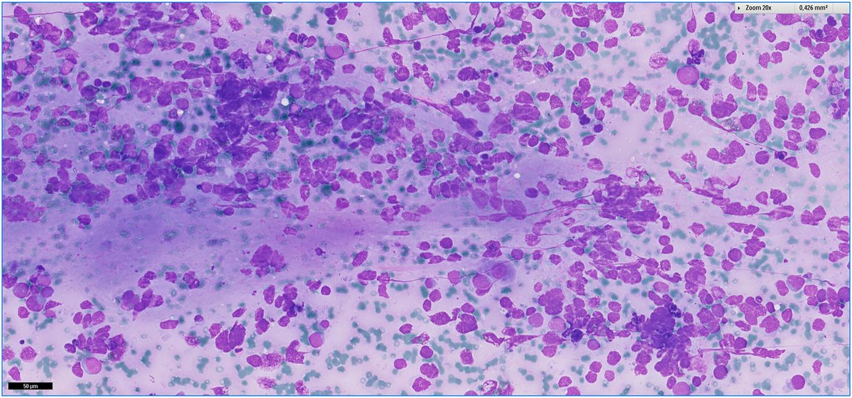 Cancer Cytopathology tweet media