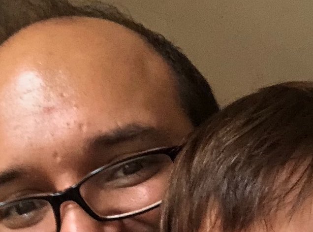 benderofbitz's tweet photo. @DARKRABBIT47 @TristanWiniarc1 😂 he’s had those same pock marks his whole life and this was like a 5min look on his TL.  Craft any story, the metadata alone and everyone but him having a drug field past… kinda telling really https://t.co/KYAU0Ol7ef