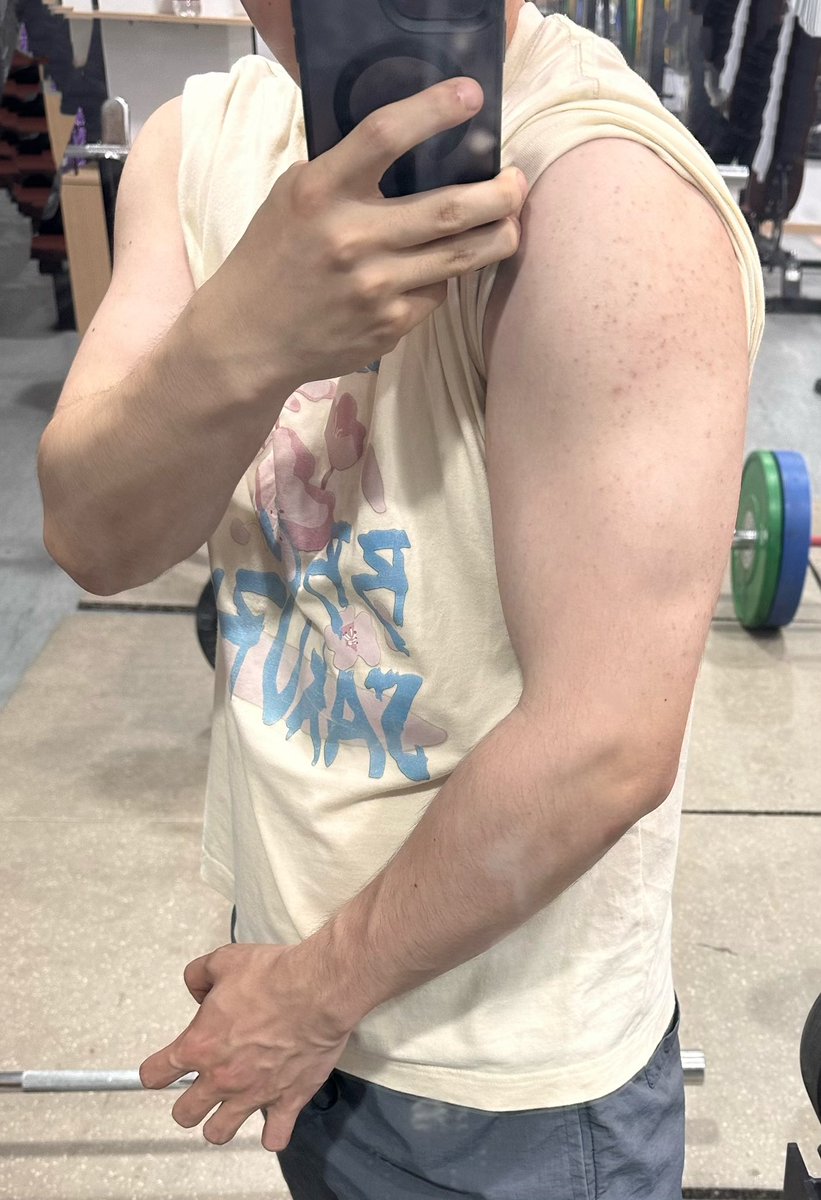 BCd85530's tweet photo. 感觉还是有变大的，就是还是肥肥的，212抽我的凯尔希你在哪啊，🥹🥹 https://t.co/9bNkz5XYFb