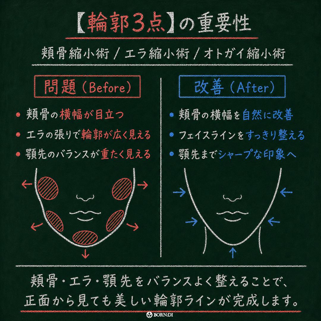 韓国ボンディ美容整形外科 BORN:DI PLASTIC SURGERY tweet media
