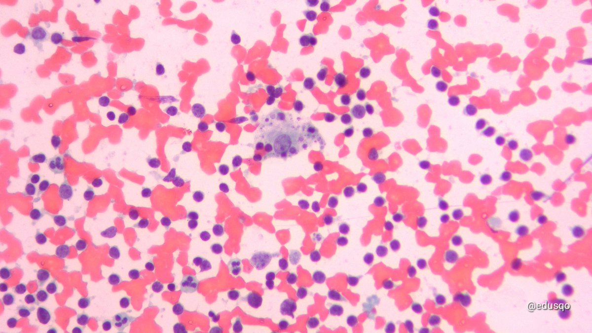 edusqo's tweet photo. Today, May 13th, honoring George Papanicolaou (1883-1962) with some pics. He developed the Pap test, a simple yet revolutionary method that changed the course of medicine by enabling early detection of disease and improving women's health worldwide. @PapSociety
#CytoPath https://t.co/LdCfruQai9