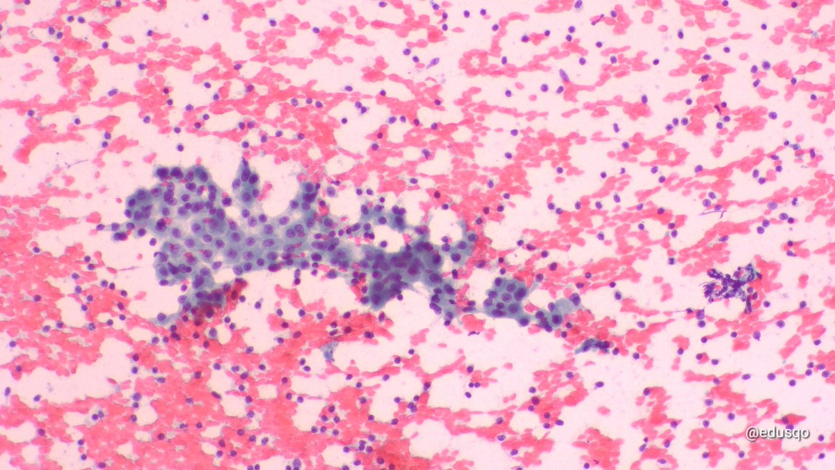 edusqo's tweet photo. Today, May 13th, honoring George Papanicolaou (1883-1962) with some pics. He developed the Pap test, a simple yet revolutionary method that changed the course of medicine by enabling early detection of disease and improving women's health worldwide. @PapSociety
#CytoPath https://t.co/LdCfruQai9