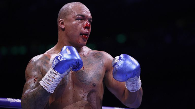 BOX1NEWS's tweet photo. Wardley has a REMATCH CLAUSE 👀 After that war with Dubois he has the right to run it back 🏴󠁧󠁢󠁥󠁮󠁧󠁿 But Frank Warren says "those fights take a lot out of you — a rematch isn't imminent." Do you want Wardley vs Dubois 2? 👇 #WardleyDubois #Boxing #Heavyweight https://t.co/WrjdFVOJhs