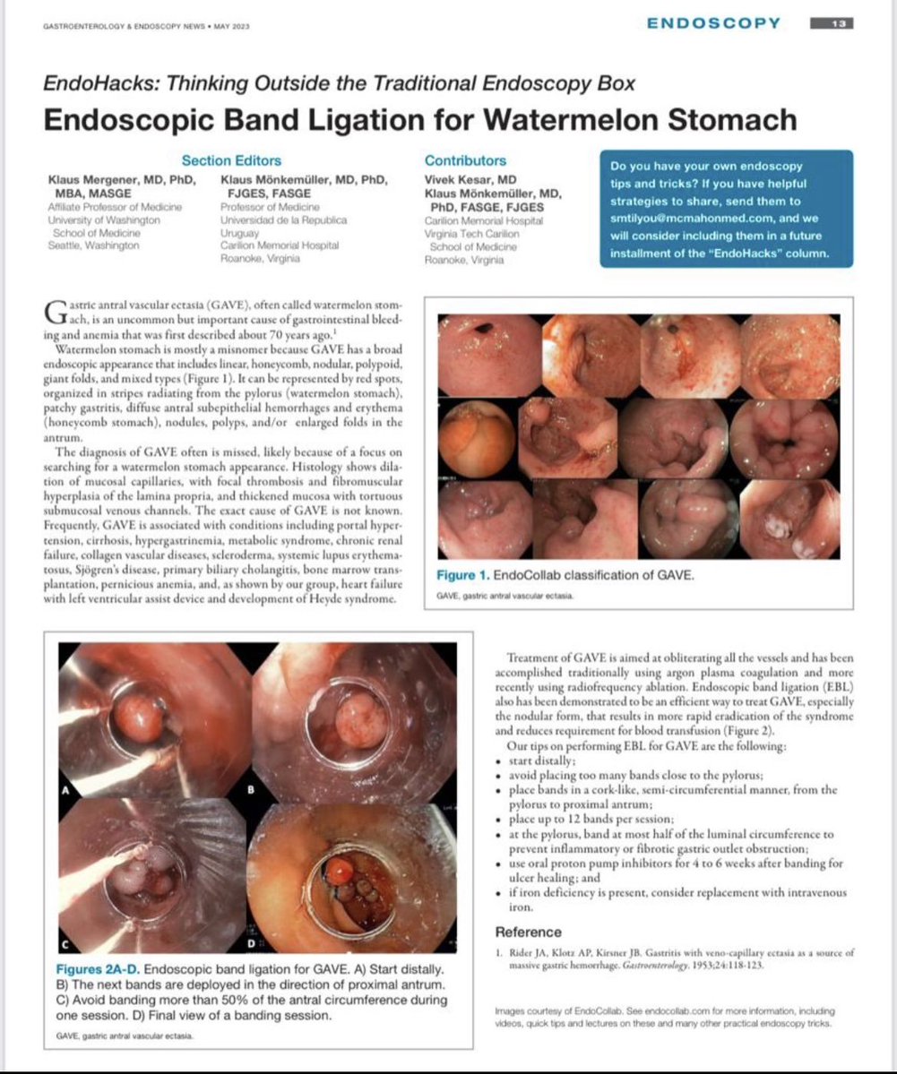 EndoCollab™ | GI Endoscopy Community tweet media
