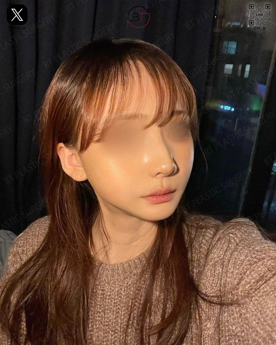 韓国BT整形外科「輪郭と鼻手術専門」 tweet media