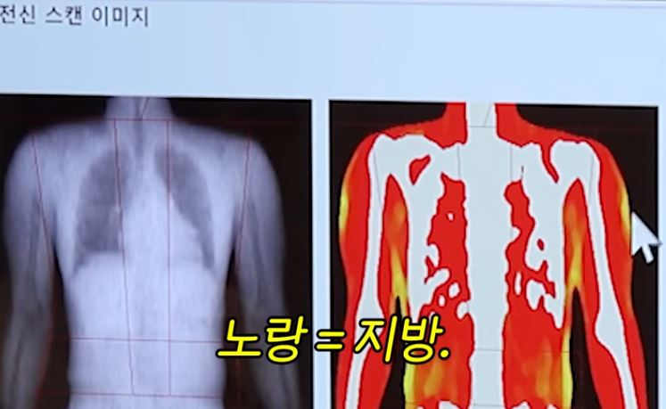 빕 tweet media