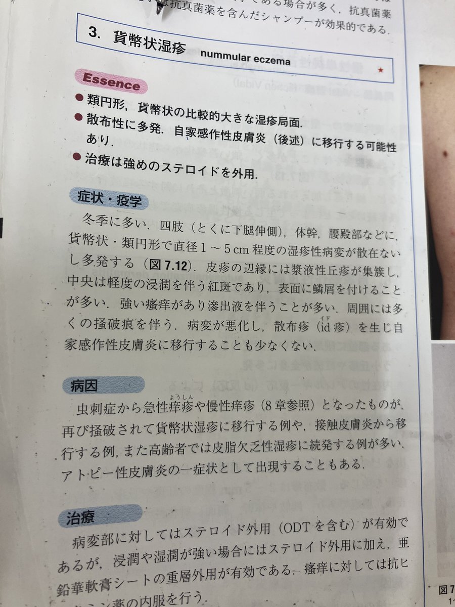 KT TS tweet media