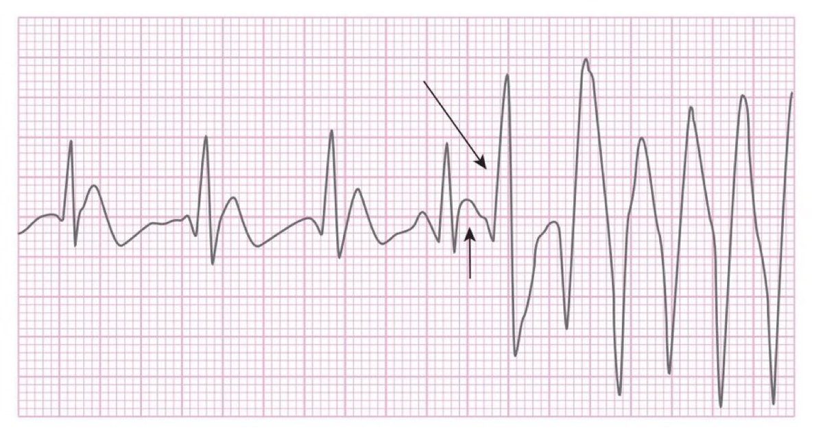 CardiovascularCorner tweet media