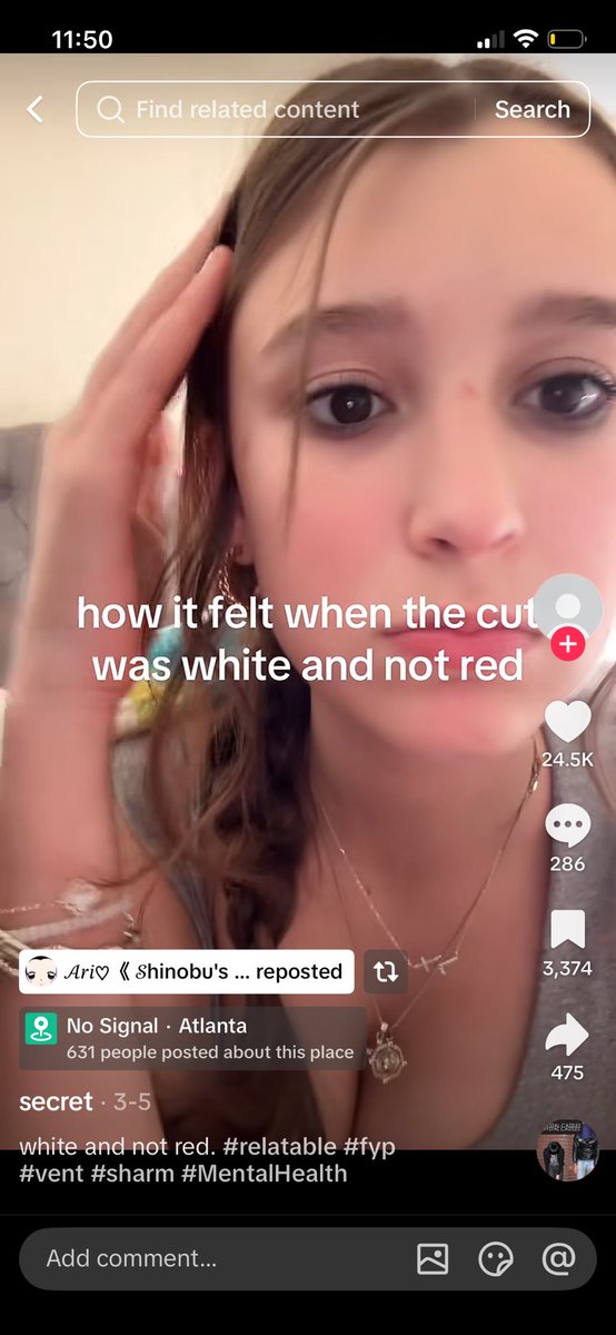Kirarasht's tweet photo. I’m laughing so hard at this ppl 😭 (every sh is valid but it’s overreacting so much) #selfharmtrigger #selfharms #shtwtt #shtwt https://t.co/wERaupFrEL