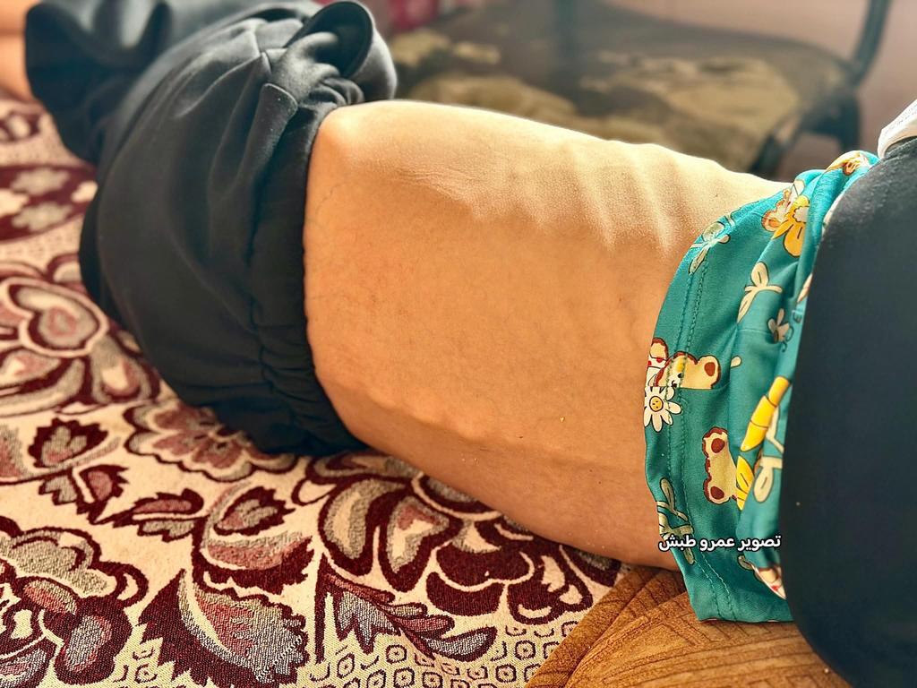 Ahmed | Gaza Guy 🇵🇸 tweet media