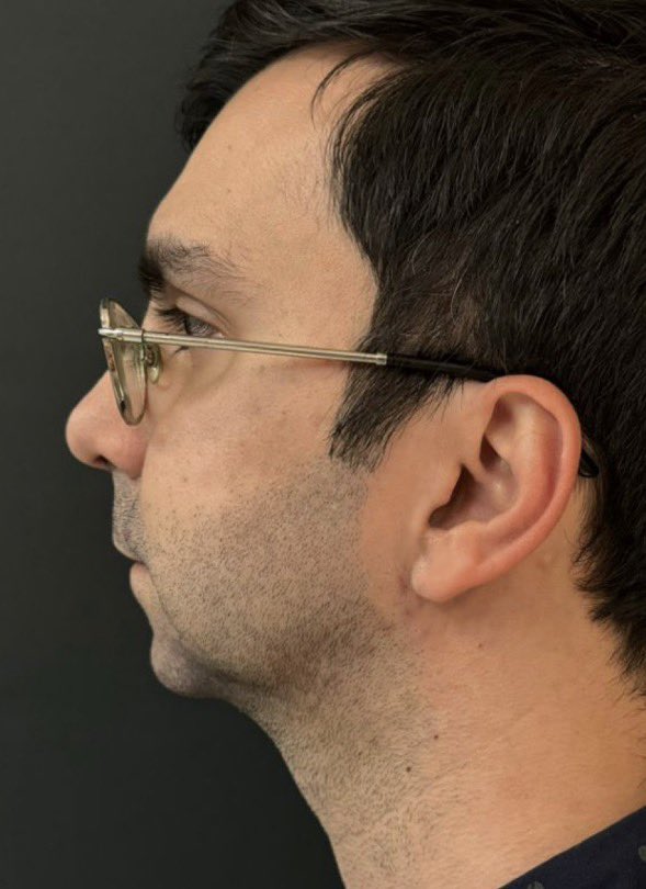 rubemdavi's tweet photo. Lembrando aqui de quando meu cirurgião plástico fez este milagre em mim https://t.co/07EN1nJ0lY