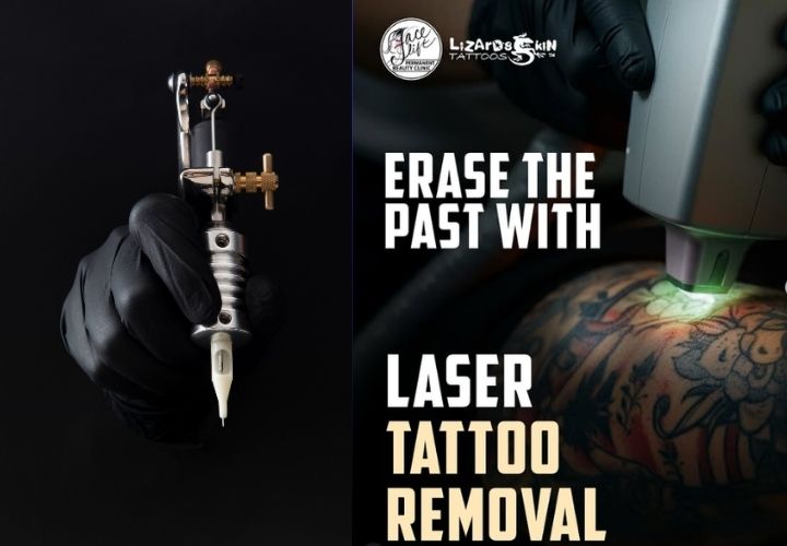 LizardsTattoos's tweet photo. Laser Tattoo Removal in Kolkata | Safe &amp; Effective

#LaserTattooRemovalKolkata, #TattooRemovalIndia, #LizardsSkinTattoos, #TattooCare, #InkRemoval

Visit Here: https://t.co/AwF4Ld6ayp https://t.co/hj6XDvIoID