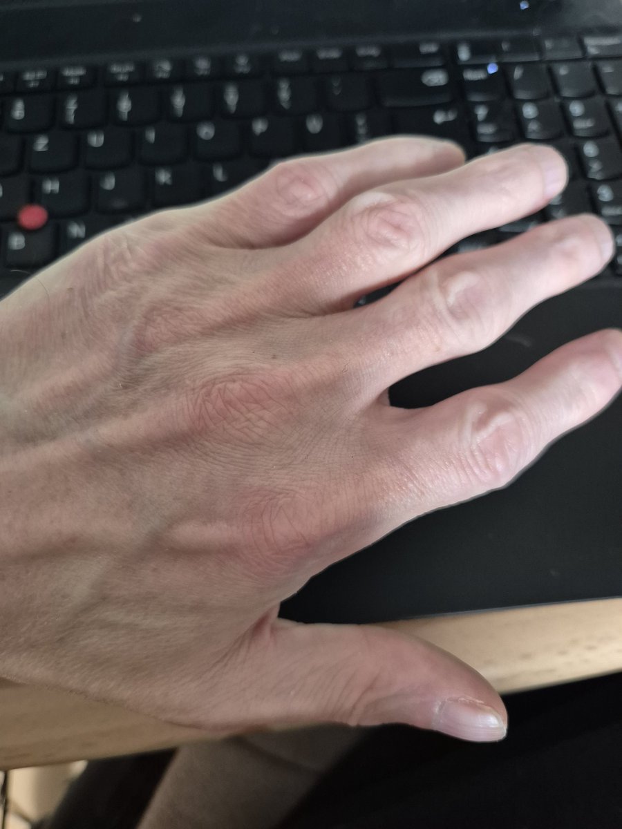 Uwe tweet media
