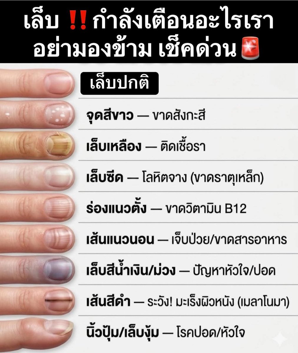 ชลน แมวส้มแท้ๆ 🐱 tweet media