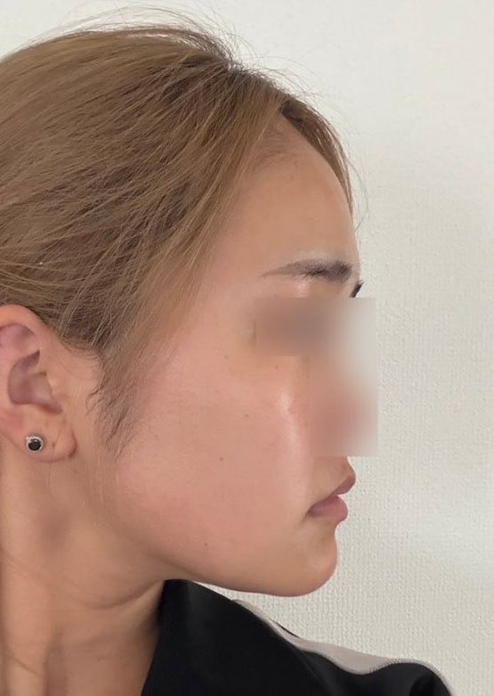 るるん tweet media