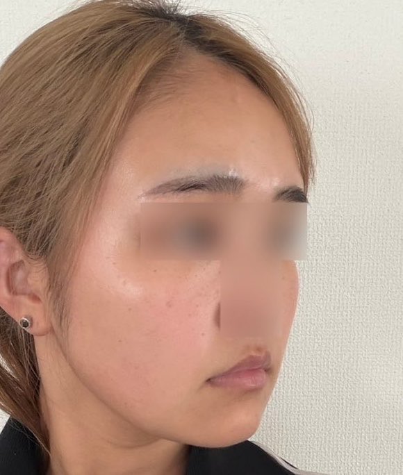 るるん tweet media