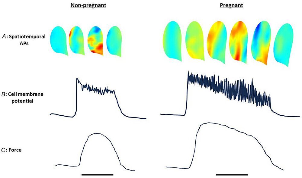 JPhysiol's tweet photo. Susan Wray (@LiverpoolWomens) and Michael J. Taggart (@UniofNewcastle) provide an update on #pacemaking in the #myometrium, reviewing the progress that has been made using recent technologies✍️ ⏰️
📜 Read the review:
https://t.co/BhYDFJFoBK https://t.co/sFPEEna9N2