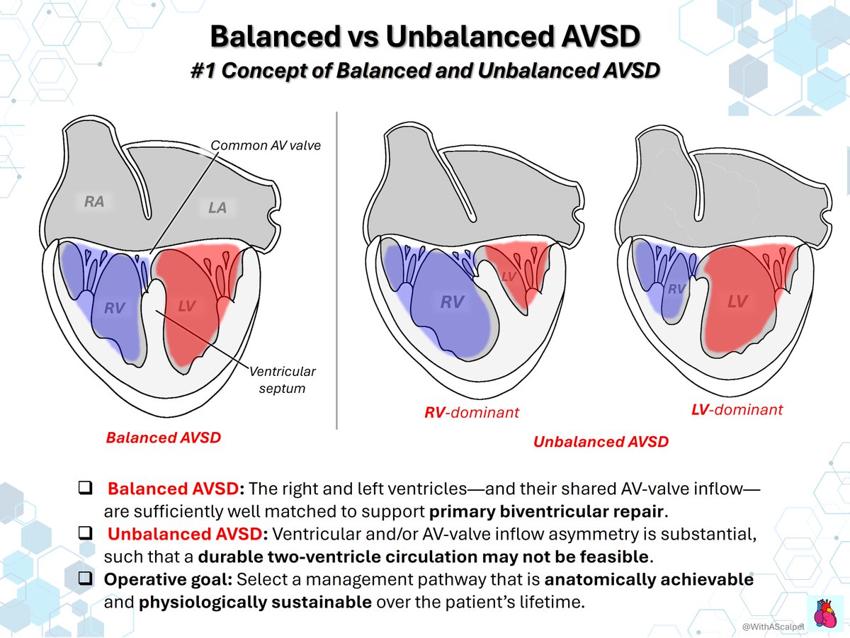 WithAScalpel's tweet photo. Balanced vs Unbalanced AVSD — From Anatomy to Strategy

👉Balanced AVSD supports a primary biventricular repair when ventricular size and AV-valve inflow are well matched.
👉Unbalanced AVSD requires careful assessment of AVVI, RV/LV inflow angle, indexed VSD, valve regurgitation, and ventricular function.
👉The goal is to choose the most durable pathway—biventricular repair, staged strategy, or single-ventricle palliation—based on anatomy and physiology.