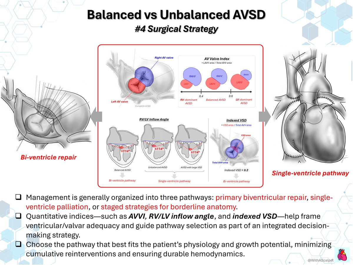 WithAScalpel's tweet photo. Balanced vs Unbalanced AVSD — From Anatomy to Strategy

👉Balanced AVSD supports a primary biventricular repair when ventricular size and AV-valve inflow are well matched.
👉Unbalanced AVSD requires careful assessment of AVVI, RV/LV inflow angle, indexed VSD, valve regurgitation, and ventricular function.
👉The goal is to choose the most durable pathway—biventricular repair, staged strategy, or single-ventricle palliation—based on anatomy and physiology.