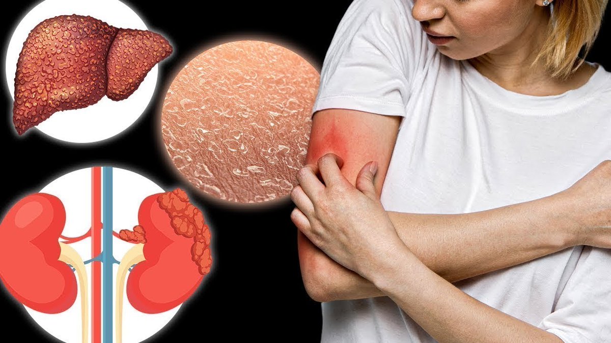 Nerve Damage Rash Constant itching is not always strictly a skin problem. Blood sugar ...