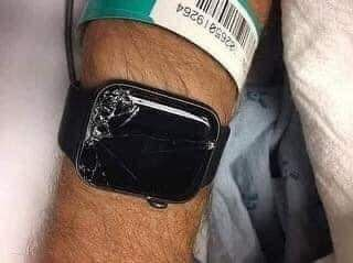 Jefersonnasa_'s tweet photo. Esta persona sufrió un grave accidente. Por suerte, llevaba puesto un Apple Watch, que monitoriza constantemente funciones vitales como la presión arterial, el pulso e incluso las caídas.

El reloj activó automáticamente una llamada de emergencia para rescatar a su dueño, localizando su posición en un mapa y enviando un mensaje de alerta a su hijo: "Tu padre ha tenido un accidente: he llamado a una ambulancia y a ti también, porque estás en su lista de emergencias".

Cuando el hijo llegó al lugar, descubrió que la ambulancia ya había trasladado a su padre a urgencias gracias a la llamada automática y que había sido rescatado. Este es un gran ejemplo de cómo la tecnología puede ser una bendición, no una maldición.

Todo depende de cómo lo usen los humanos...