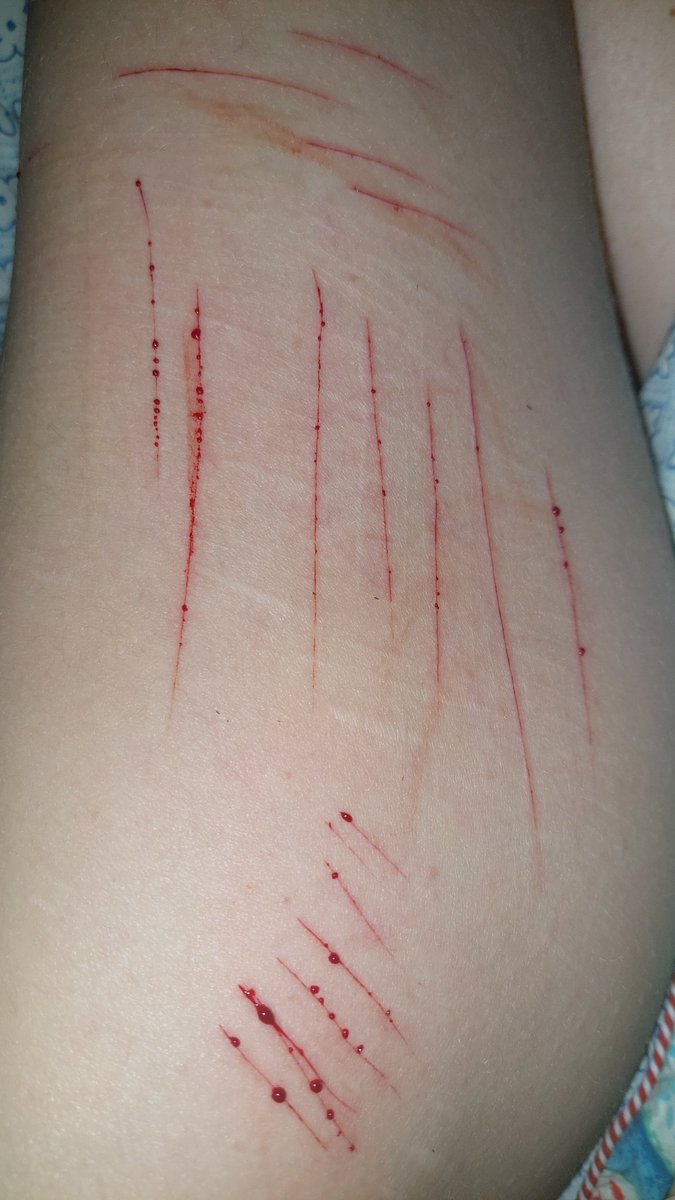 mxo_04's tweet photo. I hate how good that felt
Also i'm a little drunk rn

#relapse #shtwt #988twt https://t.co/qBjOMX9dZd