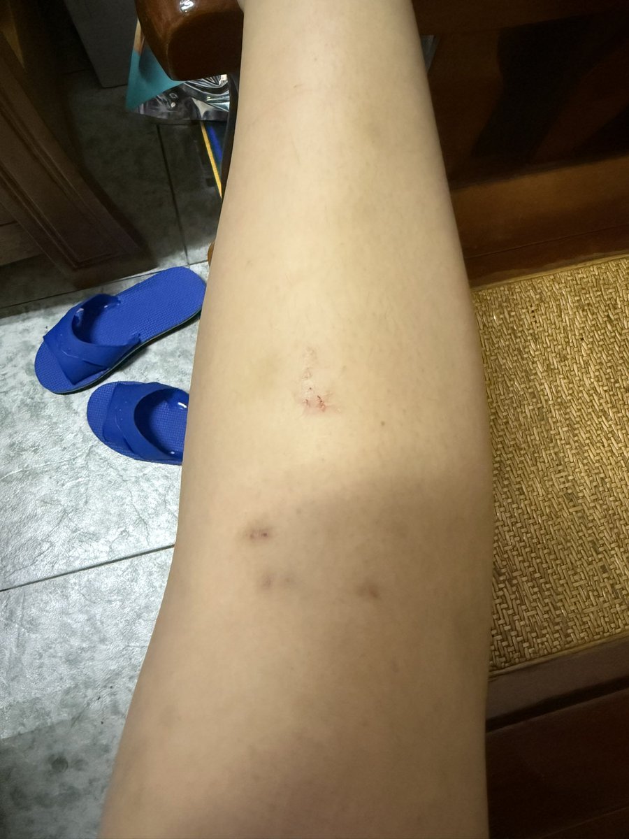 momo554109's tweet photo. 今天又再次被小六餵食小六進步了
他打的好舒服偶爾痛偶爾爽
然後為了彌補上次倒吊沒拍到照片的關係又上去一次結果整個人連吊點摔下來嗚我有烤雞不要黑單我摔一個兩隻腳都有傷手也小擦傷拔辣問我下次還上去嗎我說下次等你修好
我也是心大 https://t.co/Pck9JcwopK